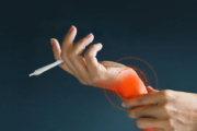 Cannabis and Arthritis: A Look at Arthritis Treatment