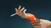 Cannabis and Arthritis: A Look at Arthritis Treatment